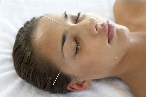 Hur man behandlar buk - och ryggsmärtor med akupunktur