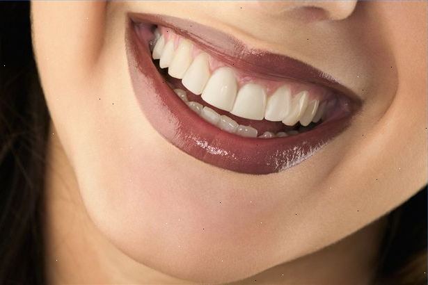 Tandköttsproblem kallas också periodontal sjukdom. Antiseptisk "chip".