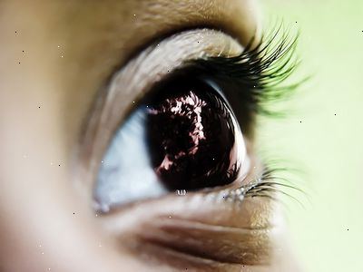 Hur att återhämta sig från katarakt ögonkirurgi